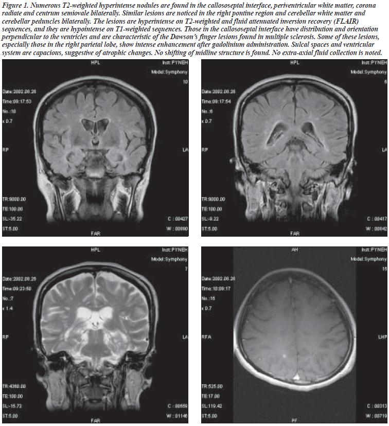 0301 V13N1 p34 figure1